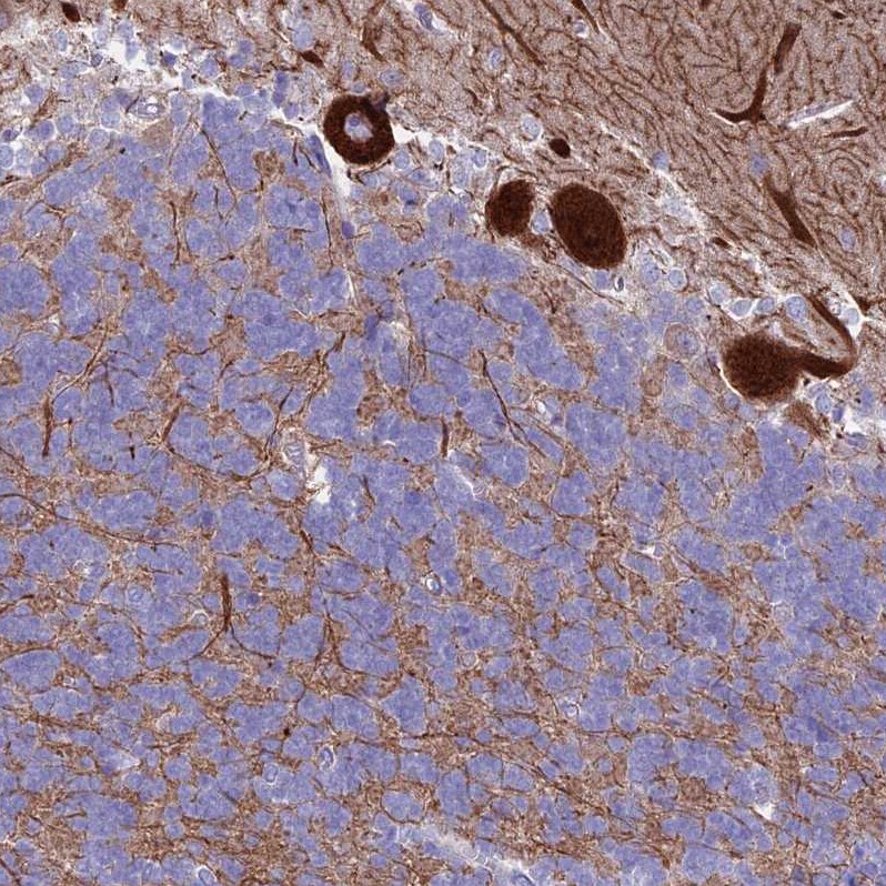 CLEC2L Antibody - BSA Free Immunohistochemistry: CLEC2L Antibody - BSA Free [NBP1-93861]