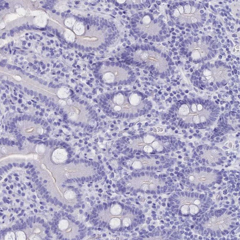 CLEC2L Antibody - BSA Free Immunohistochemistry: CLEC2L Antibody - BSA Free [NBP1-93861]