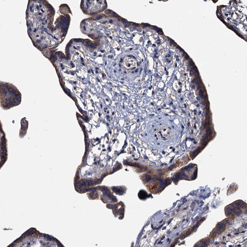 ARHGAP42 Antibody - BSA Free Immunohistochemistry-Paraffin: ARHGAP42 Antibody [NBP1-93869]