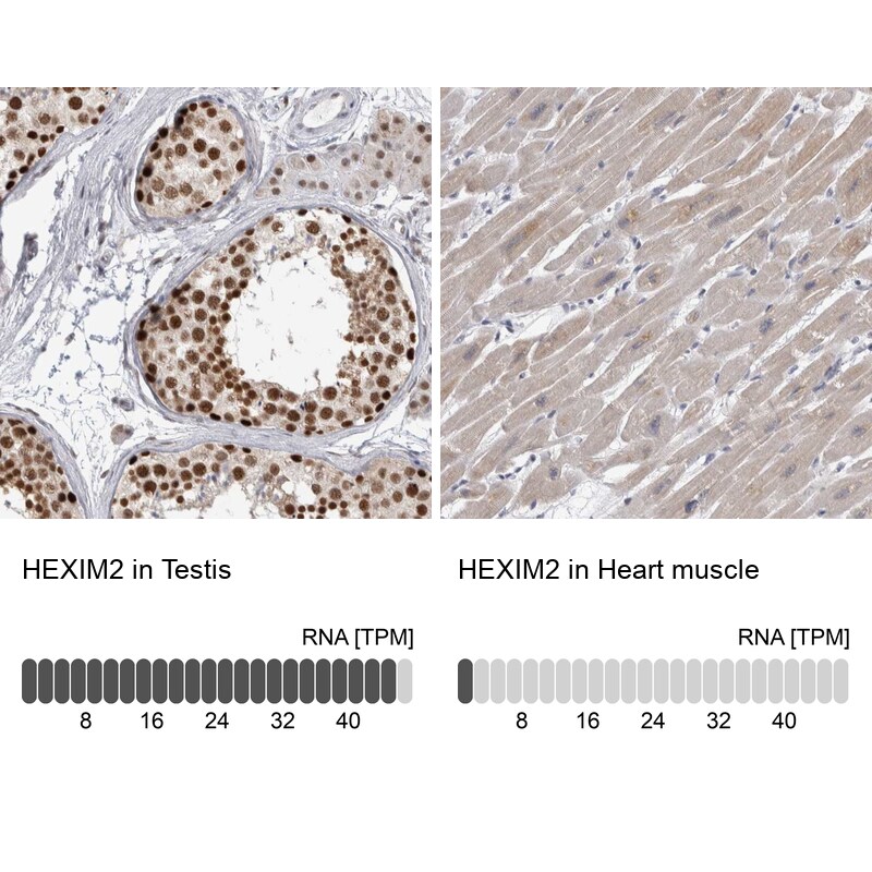 HEXIM2 Antibody - BSA Free Immunohistochemistry: HEXIM2 Antibody - BSA Free [NBP1-93876]