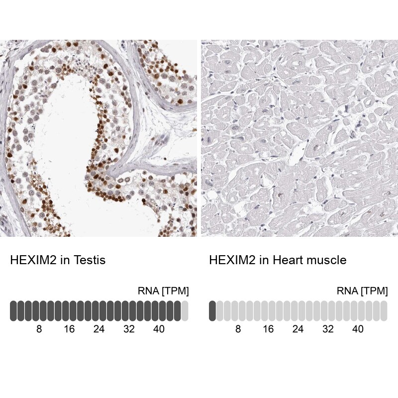 HEXIM2 Antibody - BSA Free Immunohistochemistry: HEXIM2 Antibody - BSA Free [NBP1-93877]