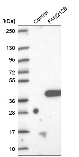 FAM212B Antibody - BSA Free Western Blot: FAM212B Antibody - BSA Free [NBP1-93887]