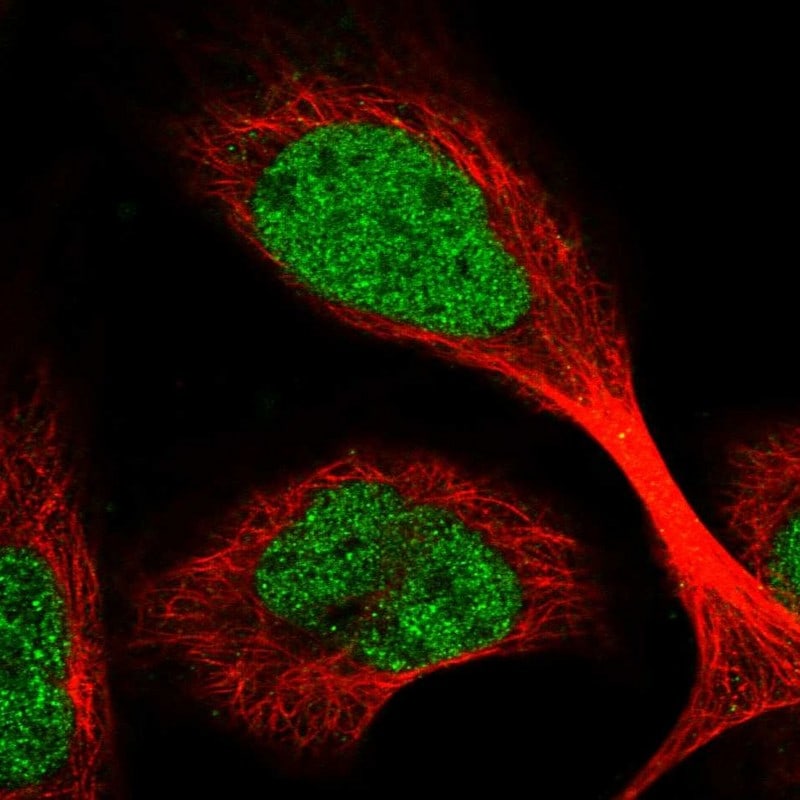 FAAP20 Antibody - BSA Free Immunocytochemistry/ Immunofluorescence: FAAP20 Antibody [NBP1-93890]