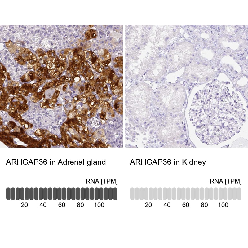 ARHGAP36 Antibody - BSA Free Immunohistochemistry: ARHGAP36 Antibody - BSA Free [NBP1-93894]