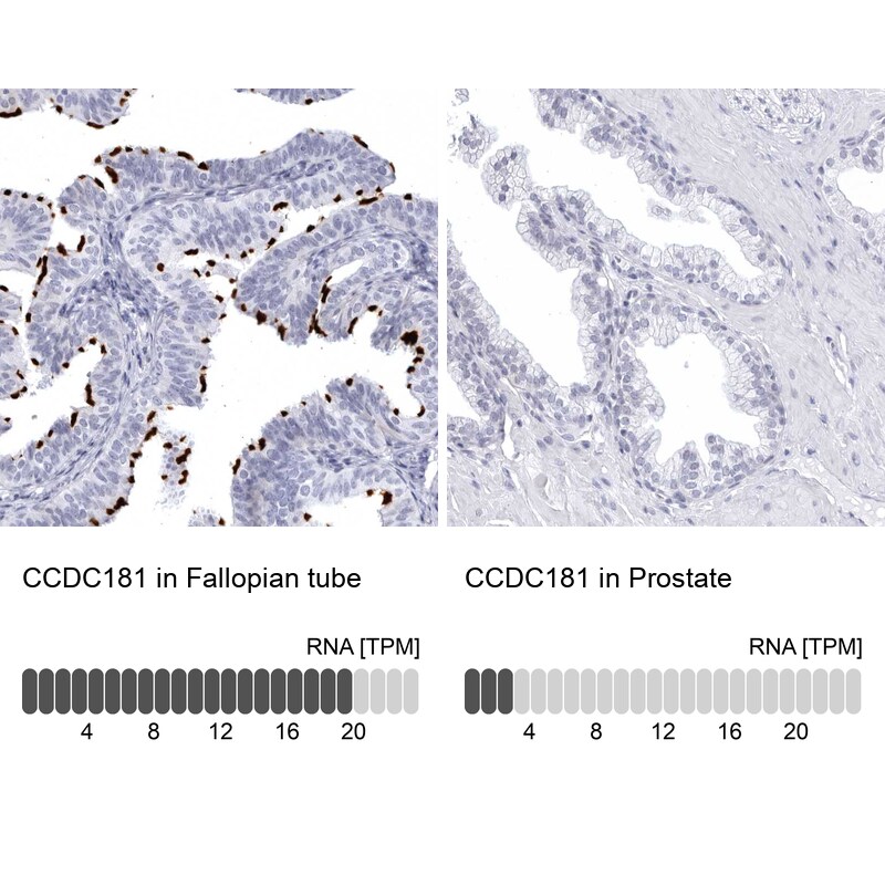 CCDC181 Antibody - BSA Free Immunohistochemistry: CCDC181 Antibody - BSA Free [NBP1-93898]