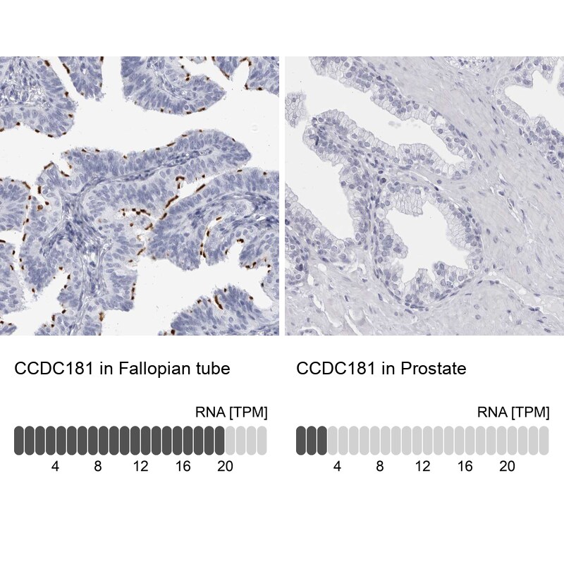 CCDC181 Antibody - BSA Free Immunohistochemistry: CCDC181 Antibody - BSA Free [NBP1-93899]