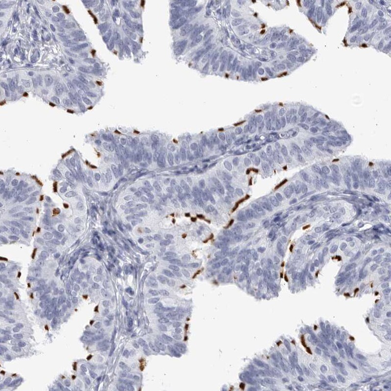 CCDC181 Antibody - BSA Free Immunohistochemistry: CCDC181 Antibody - BSA Free [NBP1-93899]
