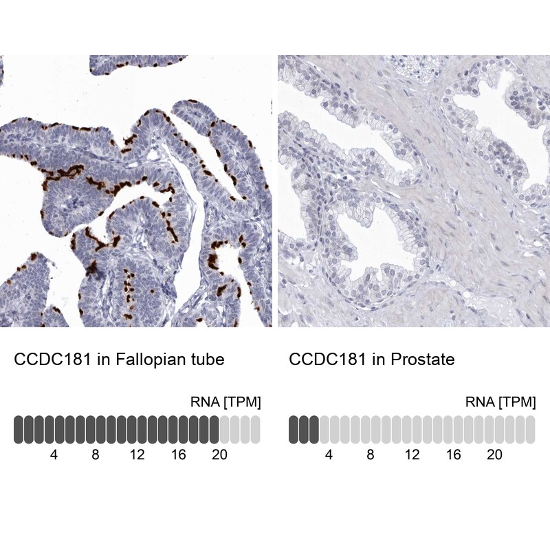 CCDC181 Antibody - BSA Free Immunohistochemistry: CCDC181 Antibody - BSA Free [NBP1-93900]