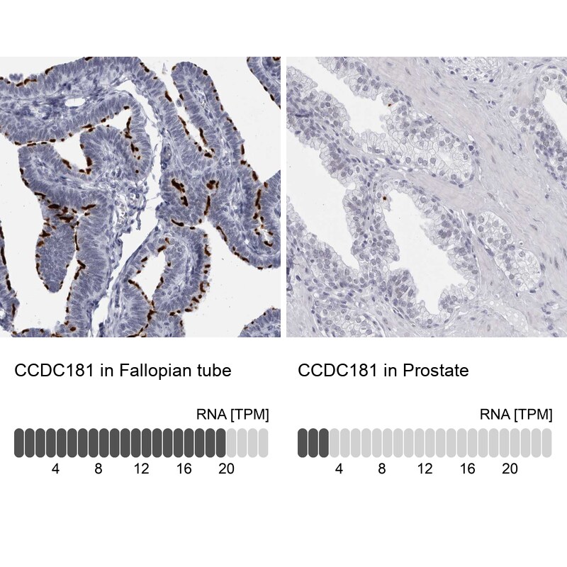 CCDC181 Antibody - BSA Free Immunohistochemistry: CCDC181 Antibody - BSA Free [NBP1-93901]