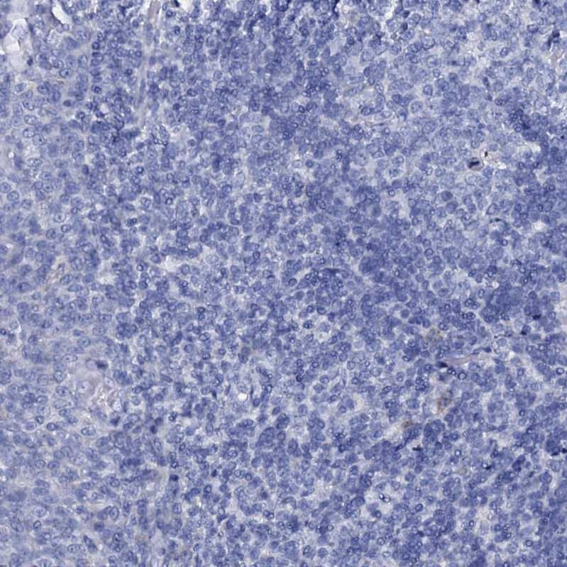 FAM123A Antibody - BSA Free Immunohistochemistry: FAM123A Antibody - BSA Free [NBP1-93907]
