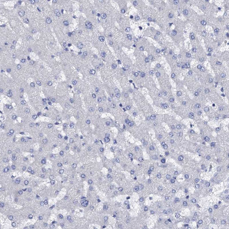 FAM123A Antibody - BSA Free Immunohistochemistry: FAM123A Antibody - BSA Free [NBP1-93907]