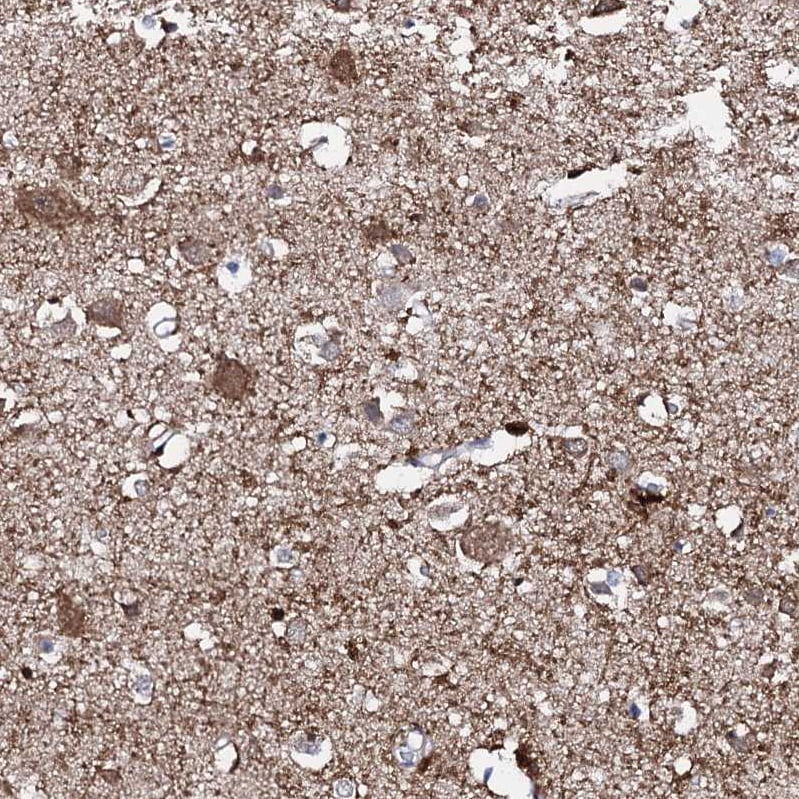 FAM123A Antibody - BSA Free Immunohistochemistry: FAM123A Antibody - BSA Free [NBP1-93907]