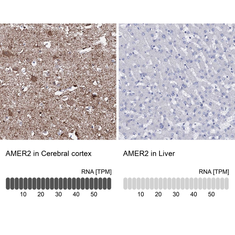 FAM123A Antibody - BSA Free Immunohistochemistry: FAM123A Antibody - BSA Free [NBP1-93907]