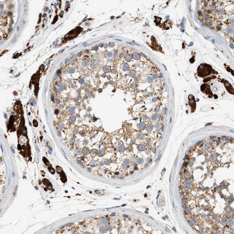 ENTHD1 Antibody - BSA Free Immunohistochemistry: ENTHD1 Antibody - BSA Free [NBP1-93911]