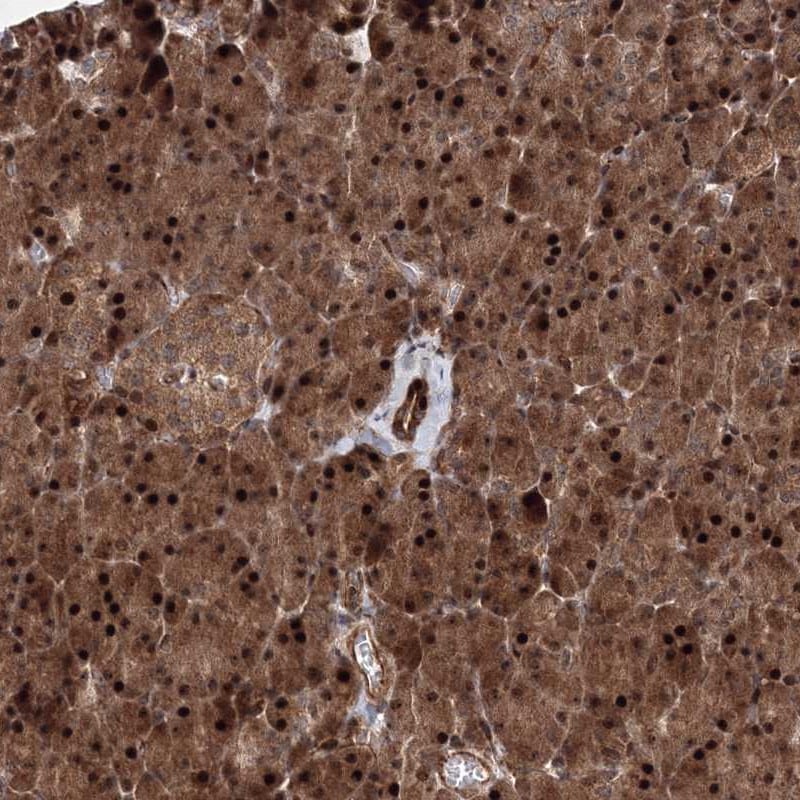 ANKAR Antibody - BSA Free Immunohistochemistry-Paraffin: ANKAR Antibody [NBP1-93912]