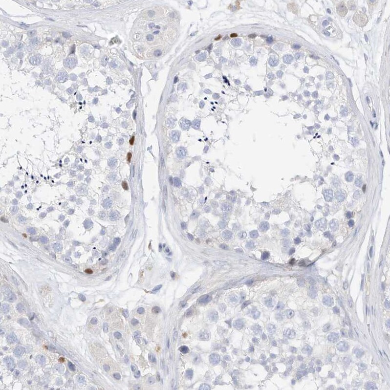 SPOCD1 Antibody - BSA Free Immunohistochemistry: SPOCD1 Antibody - BSA Free [NBP1-93922]