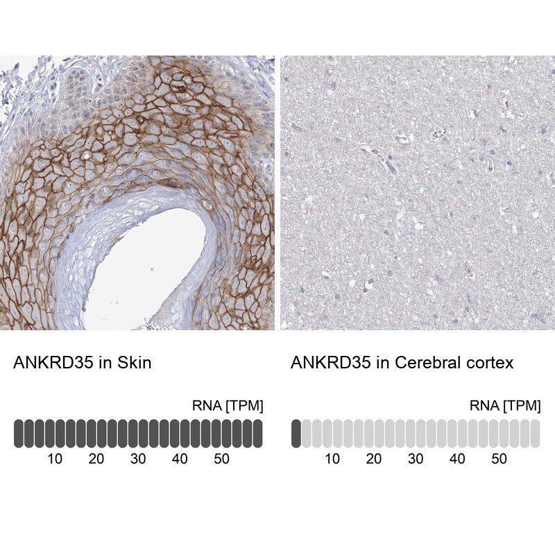 ANKRD35 Antibody - BSA Free Immunohistochemistry: ANKRD35 Antibody - BSA Free [NBP1-93924]