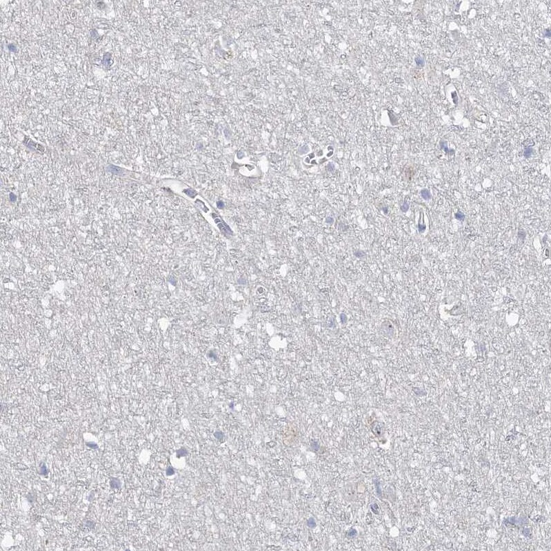 ANKRD35 Antibody - BSA Free Immunohistochemistry: ANKRD35 Antibody - BSA Free [NBP1-93924]