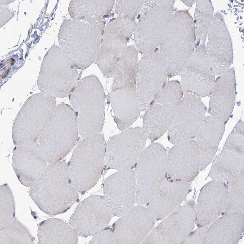 ANKRD35 Antibody - BSA Free Immunohistochemistry: ANKRD35 Antibody - BSA Free [NBP1-93924]