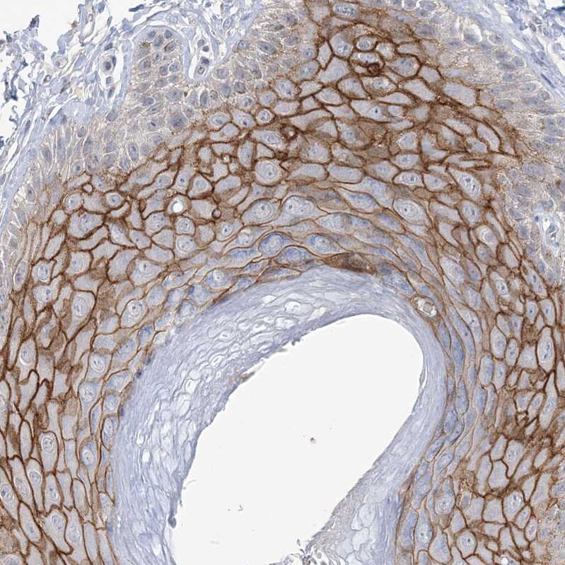 ANKRD35 Antibody - BSA Free Immunohistochemistry: ANKRD35 Antibody - BSA Free [NBP1-93924]