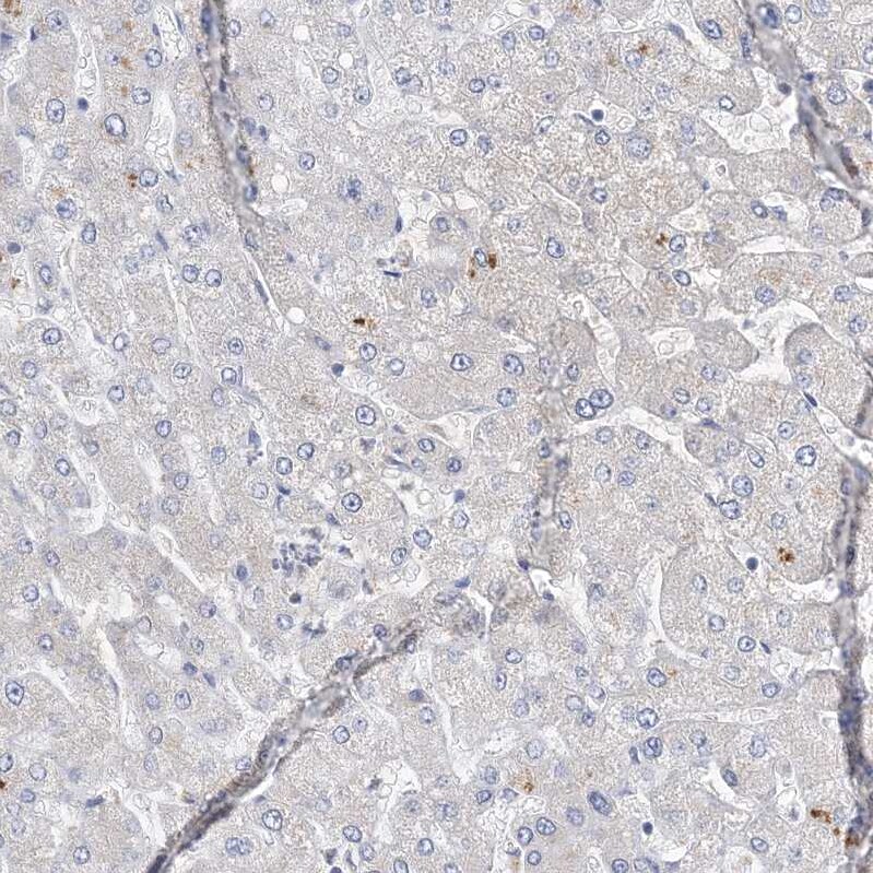 ANKRD35 Antibody - BSA Free Immunohistochemistry: ANKRD35 Antibody - BSA Free [NBP1-93924]