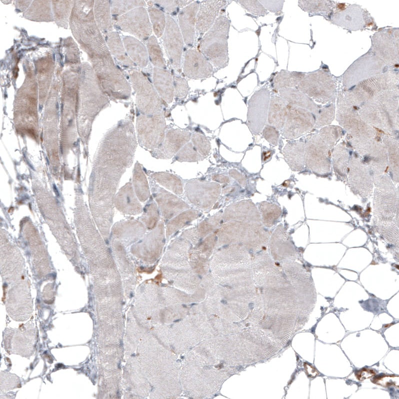 IL-17RE Antibody - BSA Free Immunohistochemistry: IL-17RE Antibody - BSA Free [NBP1-93925]