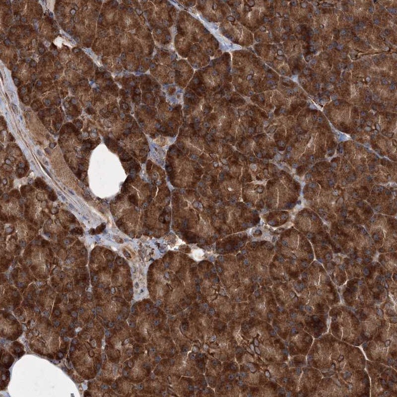SCRN3 Antibody - BSA Free Immunohistochemistry-Paraffin: SCRN3 Antibody [NBP1-93936]