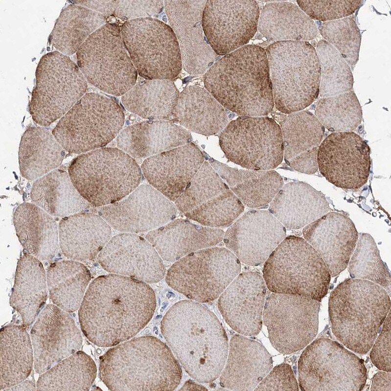 TOP6BL Antibody - BSA Free Immunohistochemistry: TOP6BL Antibody - BSA Free [NBP1-93944]