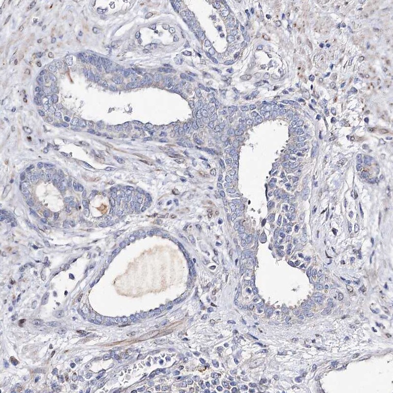 TOP6BL Antibody - BSA Free Immunohistochemistry: TOP6BL Antibody - BSA Free [NBP1-93944]