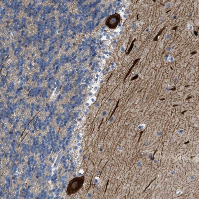PCNXL3 Antibody - BSA Free Immunohistochemistry: PCNXL3 Antibody - BSA Free [NBP1-93945]