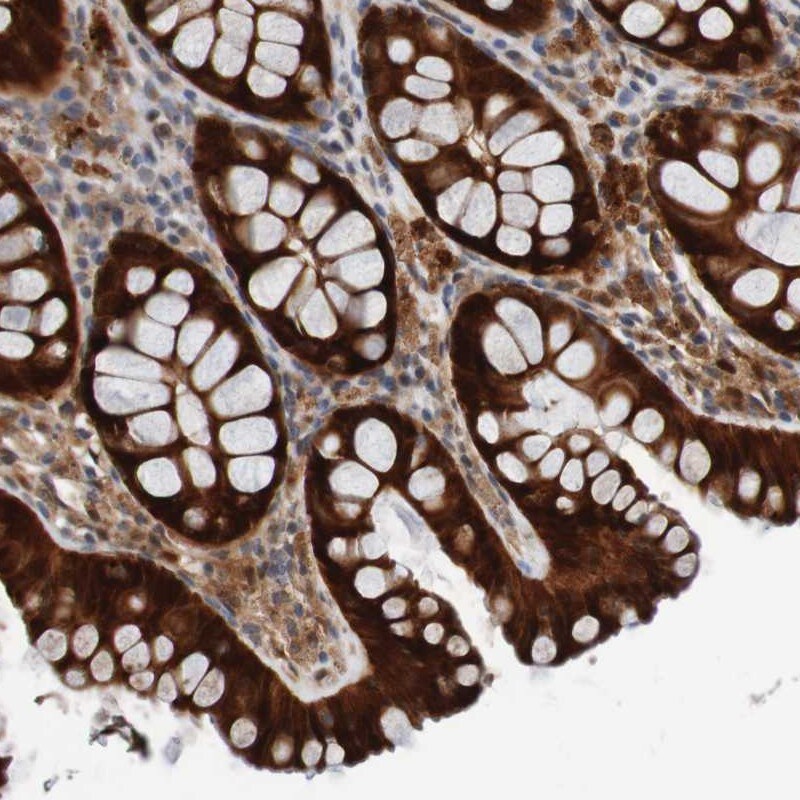 CPED1 Antibody - BSA Free Immunohistochemistry-Paraffin: CPED1 Antibody [NBP1-93947]