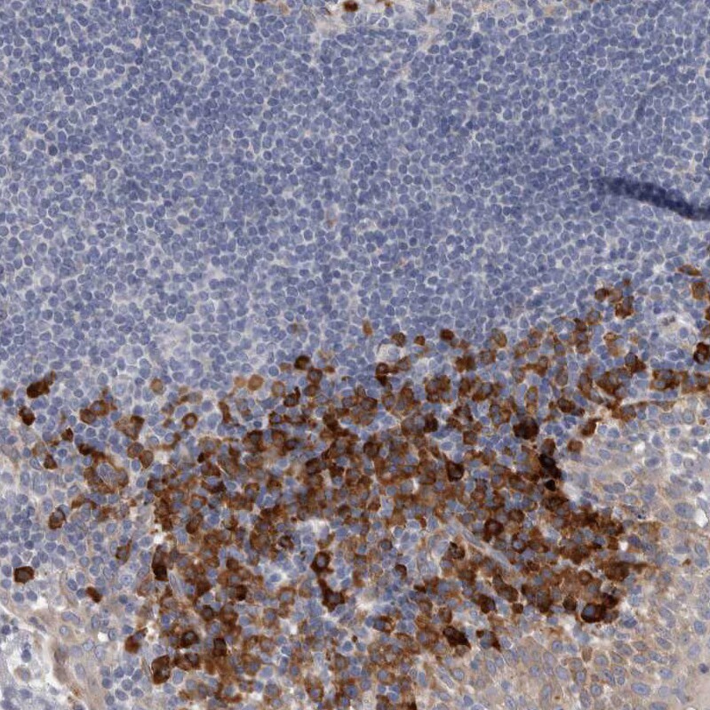 ENGASE Antibody - BSA Free Immunohistochemistry: ENGASE Antibody - BSA Free [NBP1-93948]