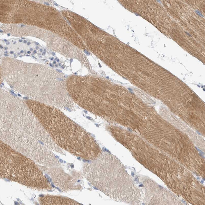 ENGASE Antibody - BSA Free Immunohistochemistry: ENGASE Antibody - BSA Free [NBP1-93948]