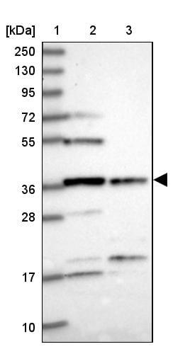FAM118B Antibody - BSA Free Western Blot: FAM118B Antibody - BSA Free [NBP1-93959]