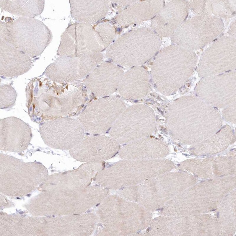 SH3PXD2B Antibody - BSA Free Immunohistochemistry: SH3PXD2B Antibody - BSA Free [NBP1-93965]