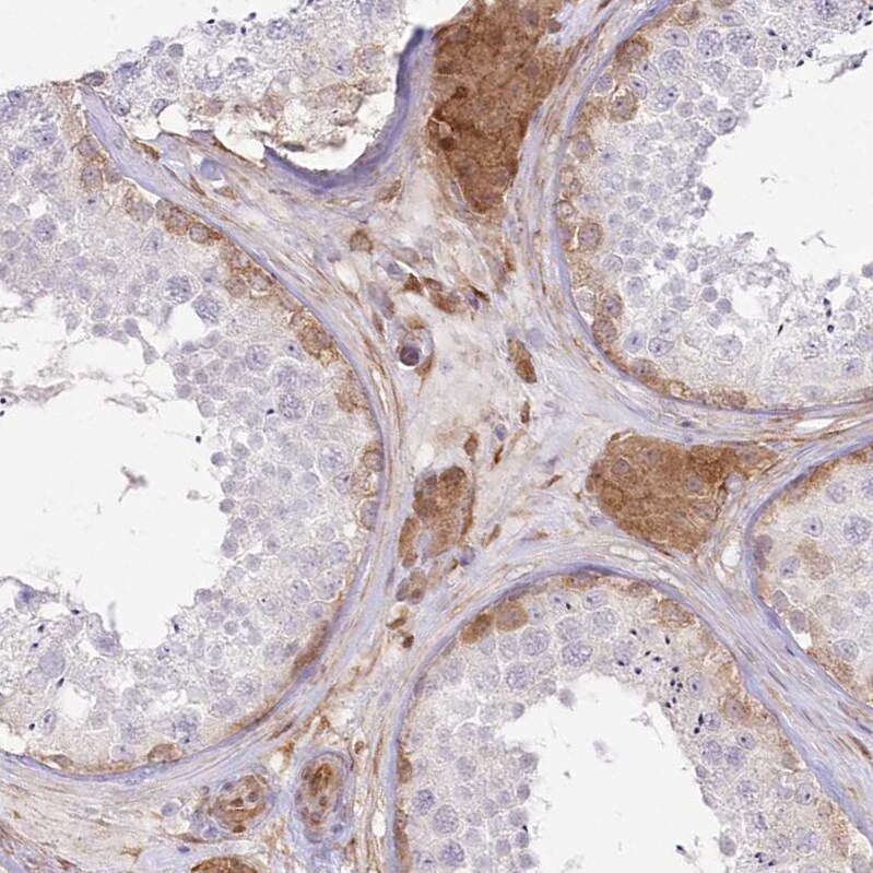 SH3PXD2B Antibody - BSA Free Immunohistochemistry: SH3PXD2B Antibody - BSA Free [NBP1-93965]