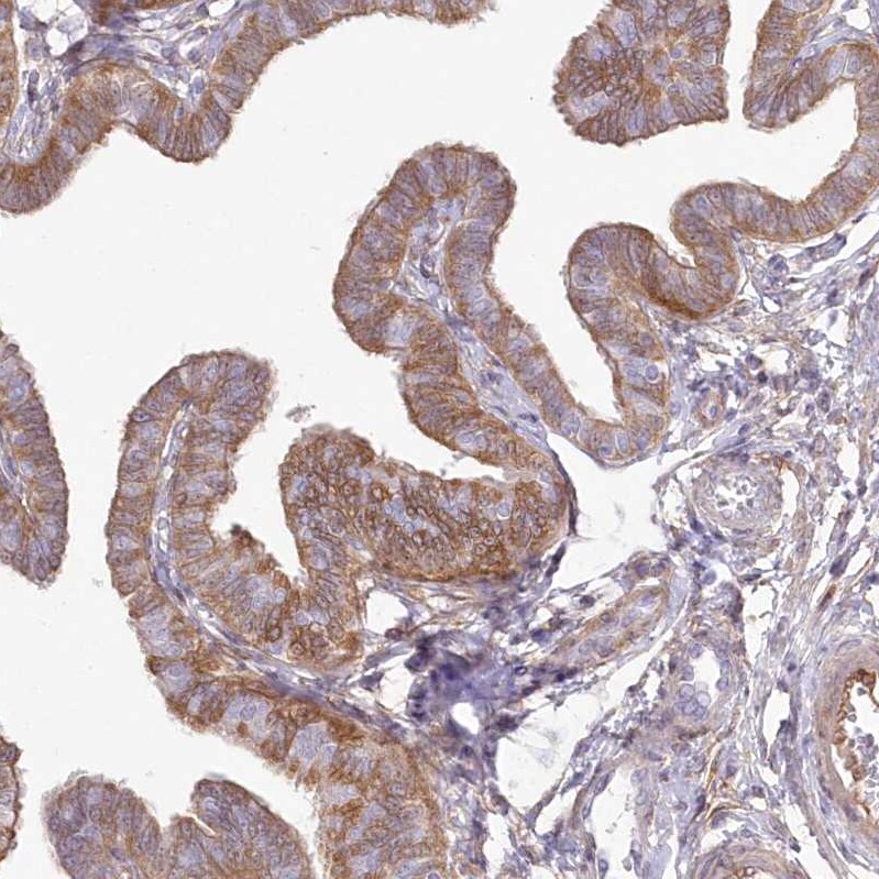 SH3PXD2B Antibody - BSA Free Immunohistochemistry: SH3PXD2B Antibody - BSA Free [NBP1-93965]