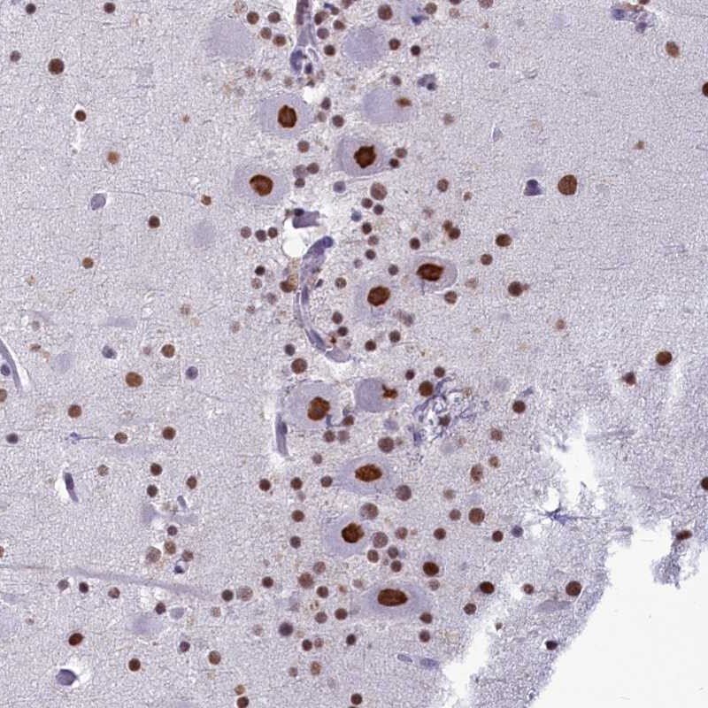 PARPBP Antibody - BSA Free Immunohistochemistry-Paraffin: PARPBP Antibody [NBP1-93969]
