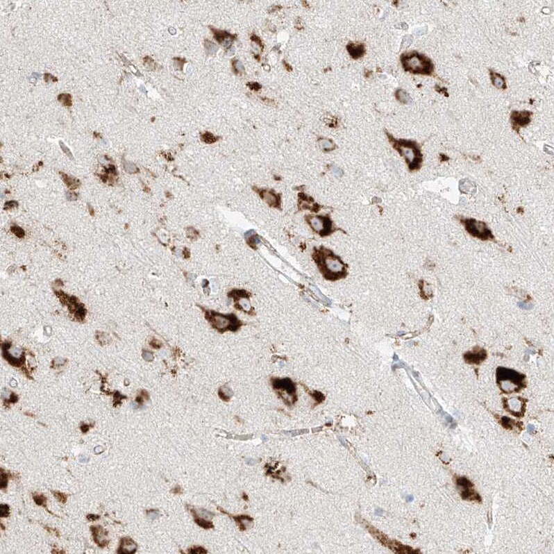 SLC35F6 Antibody - BSA Free Immunohistochemistry: SLC35F6 Antibody - BSA Free [NBP1-93972]