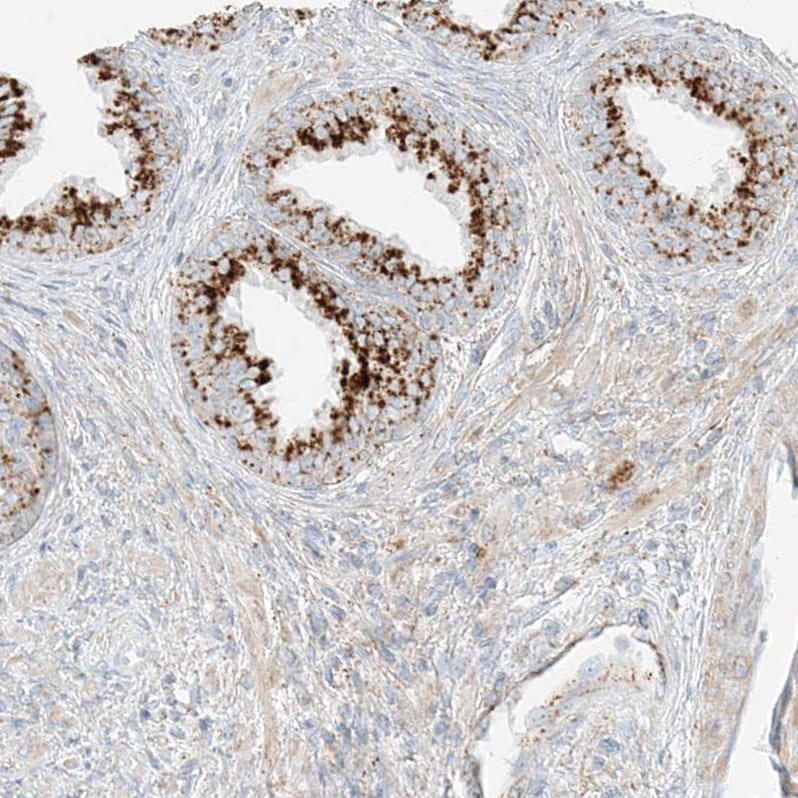 SLC35F6 Antibody - BSA Free Immunohistochemistry: SLC35F6 Antibody - BSA Free [NBP1-93972]