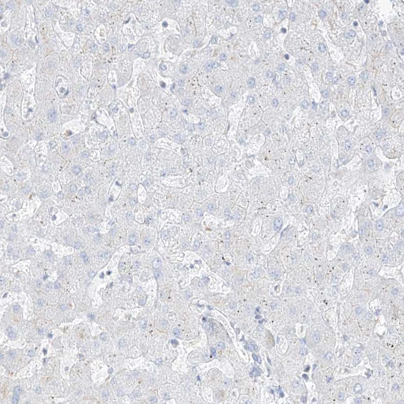SLC35F6 Antibody - BSA Free Immunohistochemistry: SLC35F6 Antibody - BSA Free [NBP1-93972]
