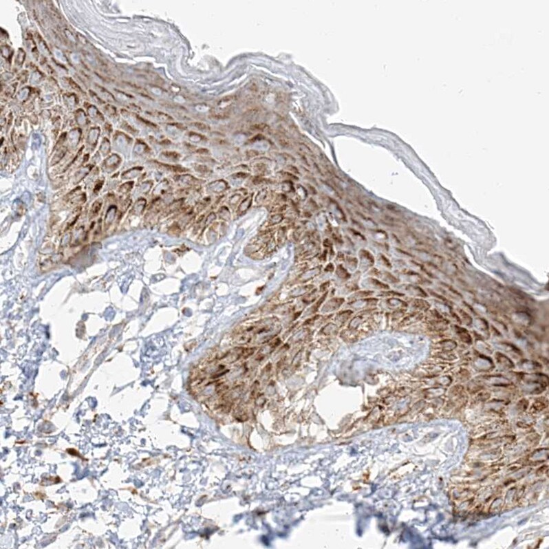 SLC35F6 Antibody - BSA Free Immunohistochemistry: SLC35F6 Antibody - BSA Free [NBP1-93972]