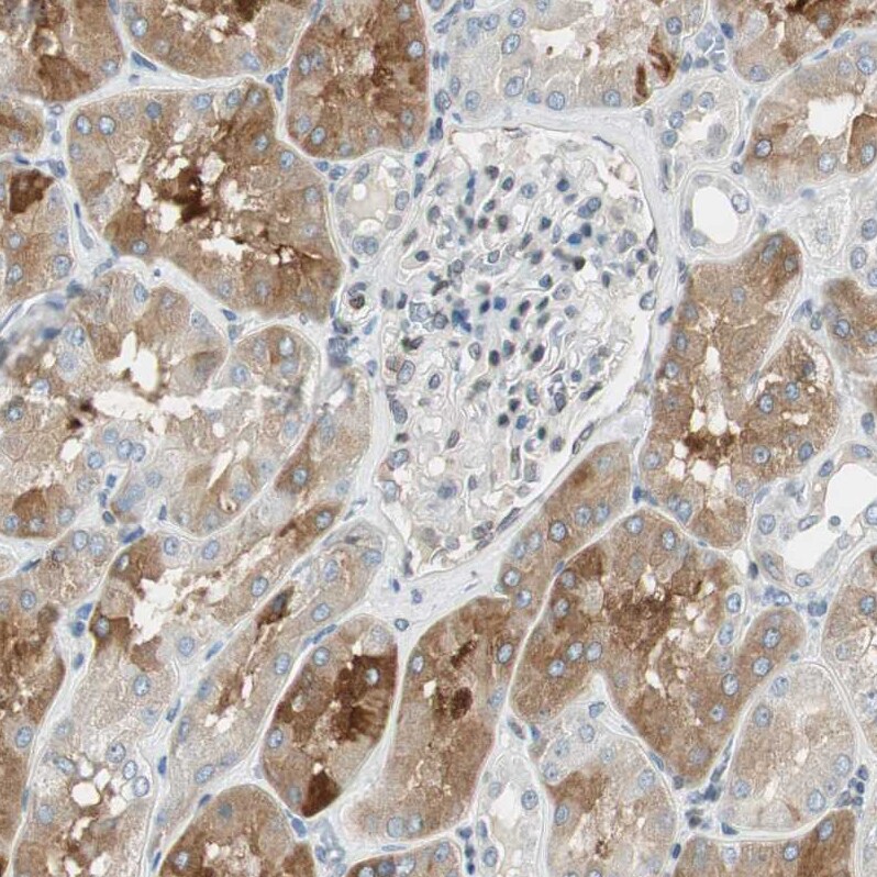 TMEM260 Antibody - BSA Free Immunohistochemistry: TMEM260 Antibody - BSA Free [NBP1-93976]