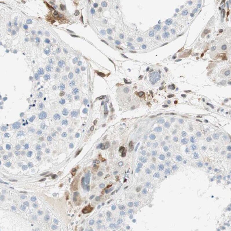 TMEM260 Antibody - BSA Free Immunohistochemistry: TMEM260 Antibody - BSA Free [NBP1-93976]
