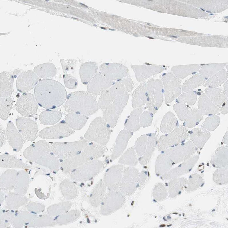 TMEM260 Antibody - BSA Free Immunohistochemistry: TMEM260 Antibody - BSA Free [NBP1-93976]