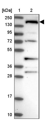 SH3TC1 Antibody - BSA Free Western Blot: SH3TC1 Antibody - BSA Free [NBP1-93978]