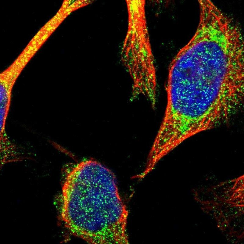 TTC19 Antibody - BSA Free Immunocytochemistry/ Immunofluorescence: TTC19 Antibody [NBP1-93979]