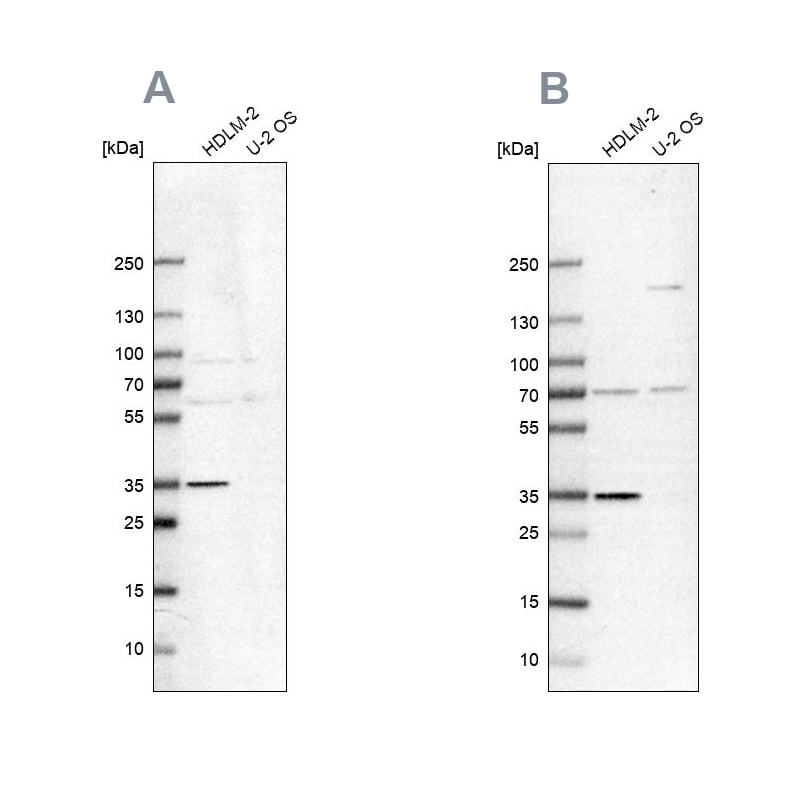 TTC19 Antibody - BSA Free Western Blot: TTC19 Antibody - BSA Free [NBP1-93979]
