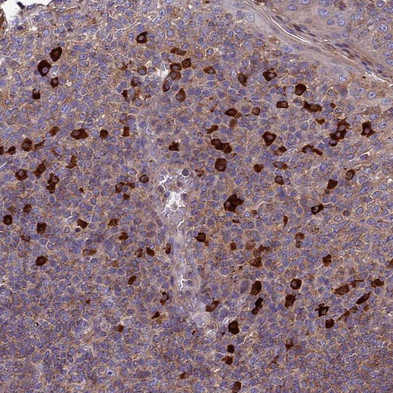 MIOS Antibody - BSA Free Immunohistochemistry: MIOS Antibody - BSA Free [NBP1-93980]