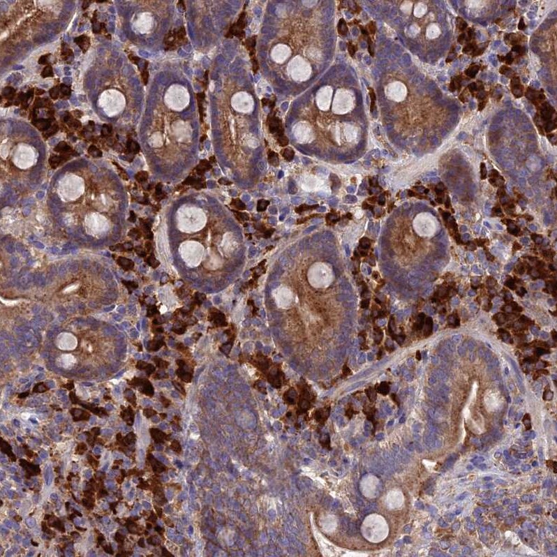 MIOS Antibody - BSA Free Immunohistochemistry: MIOS Antibody - BSA Free [NBP1-93980]